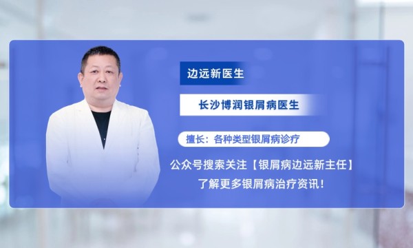 关于银屑病患者光疗辐射疑虑，长沙银屑病医生边远新来解答