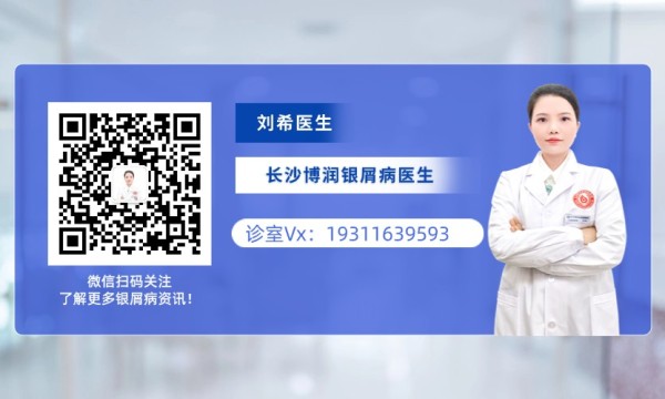 湖南省银屑病医院刘希医生科普：银屑病发病与性别年龄关系解析